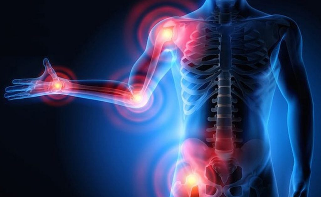 Anti-Inflammatory Effects dhm Anti-Inflammatory Effects dhm