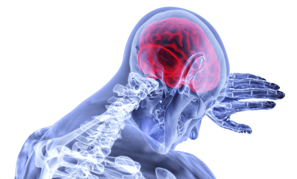 Reduced Risk Stroke From Plant Based Diet